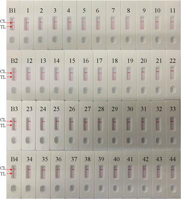 Loop-Mediated Isothermal Amplification Coupled With Nanoparticle-Based Lateral Biosensor for Rapid, Sensitive, and Specific Detection of Bordetella pertussis